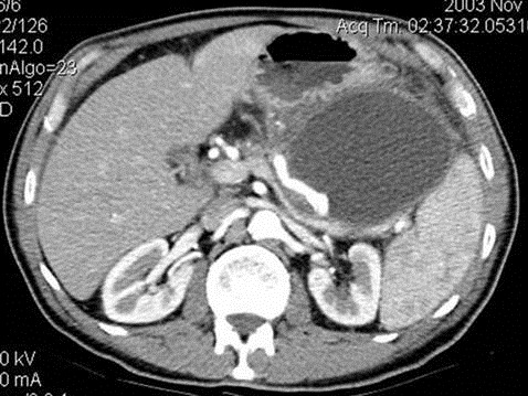 Nang giả - Hình ảnh minh họa